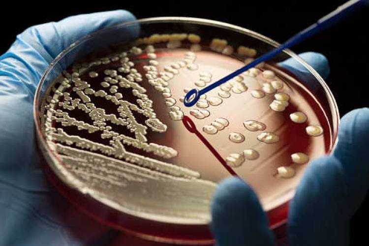 Breakthrough: Fighting 'superbugs' using skin as shield